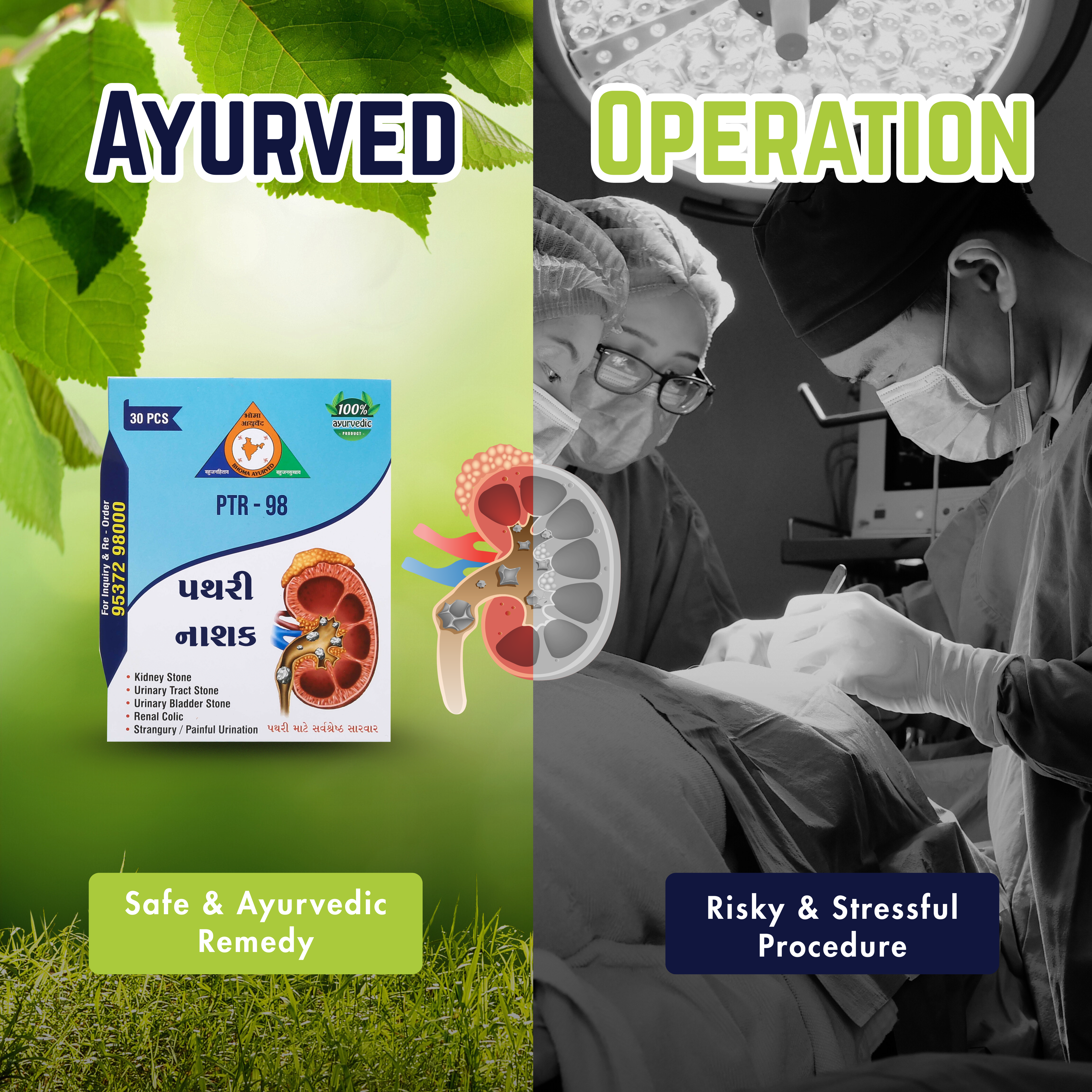 Pathri Nashak by Bhoma Ayurved